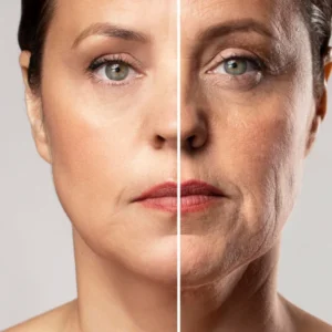 Femme avant et après un lifting facial, montrant une amélioration de l'apparence et de la circulation sanguine.