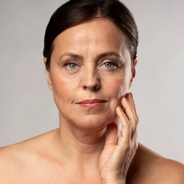 A woman with a very thin face and neck, showcasing the effects of a neuromodulator injection.