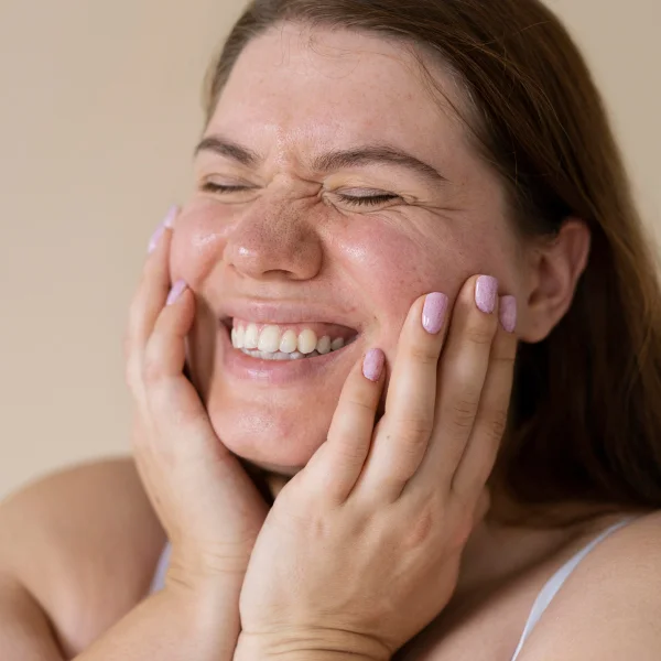 A smiling woman holds her hands to her face, showcasing the effects of a hyaluronic acid injection.